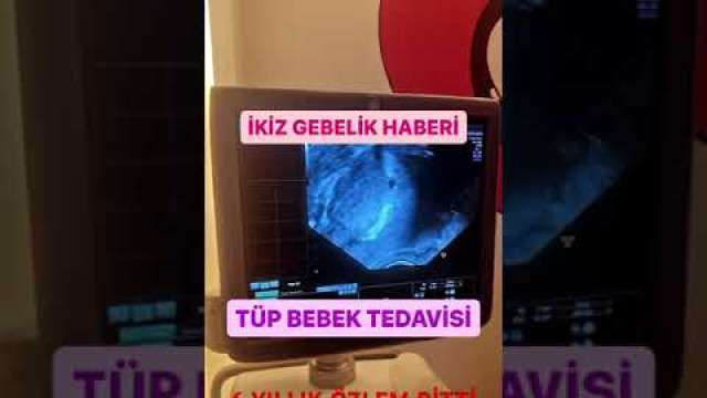 video,paylaşım,kameralı telefon,videofon,ücretsiz,yükleme