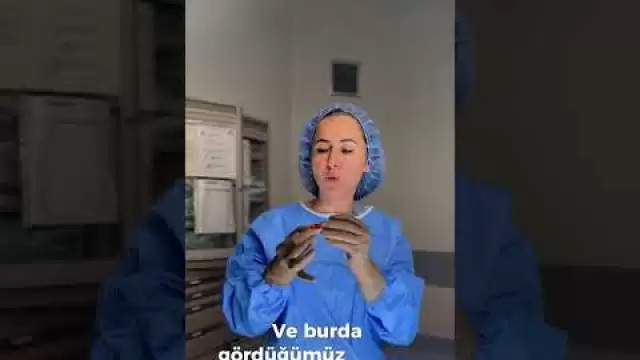 Leep Konizasyon 👍👍 . HPV TEDAVİSİ