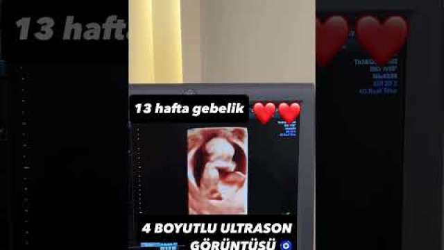 video,paylaşım,kameralı telefon,videofon,ücretsiz,yükleme