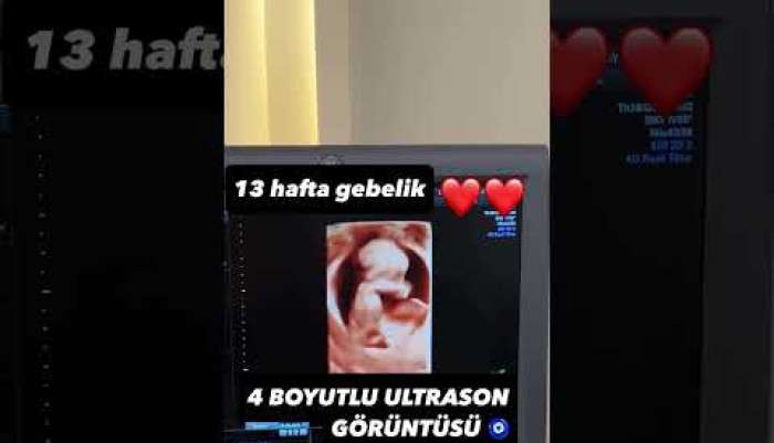 video,paylaşım,kameralı telefon,videofon,ücretsiz,yükleme