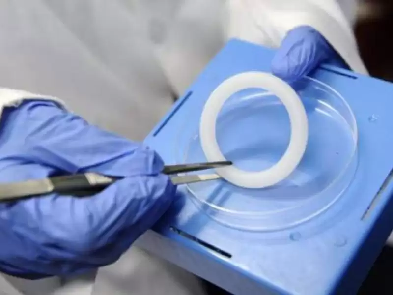 gebeligi-onleyici-cerrahi-yontemler